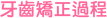 牙齒矯正過程
